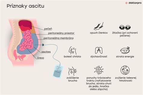 Schéma diagnostiky ascitu