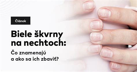 Ilustrácia pečatenia zubnej jamky na molári