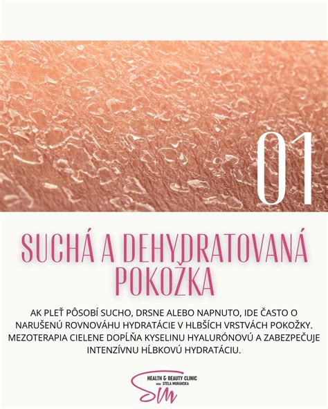 Dôležitosť hydratácie pokožky