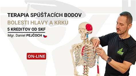 Obrázok: Lokalizácia spúšťacích bodov pri myofasciálnej bolesti