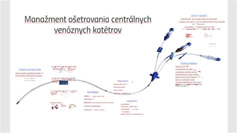 Techniky zavádzania centrálnych venóznych katétrov u detí
