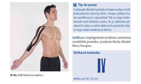 Kineziologické tejpovanie lakťa