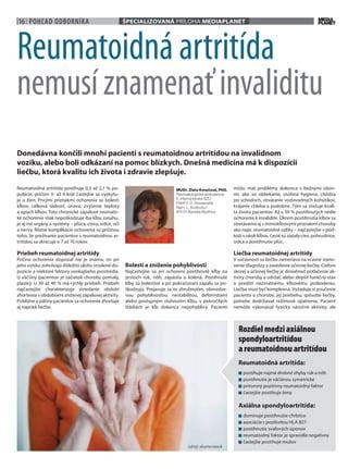 Infografika o dopade reumatoidnej artritídy na kĺby