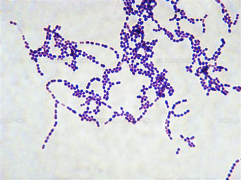 Bakterie Streptococcus pyogenes pod mikroskopom