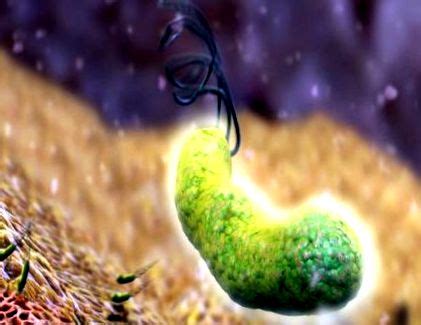 Baktéria Helicobacter pylori pod mikroskopom