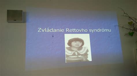 Porovnanie štádií Rettovho syndrómu