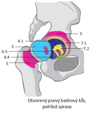 Zdravý a poškodený bedrový kĺb pri artróze