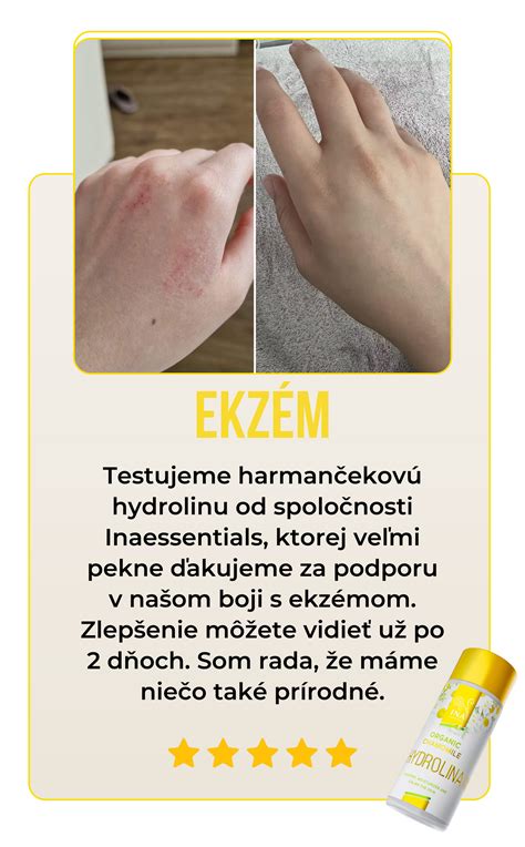 Znaky upokojenej a hydratovanej pokožky