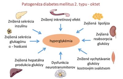 Patogenéza diabetes mellitus 2. typu