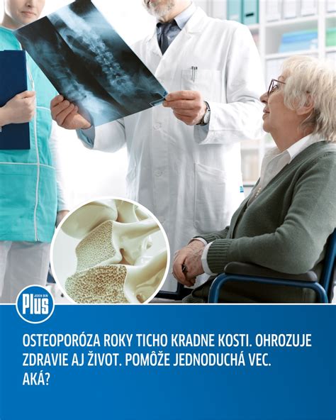Prevalencia osteoporózy u mužov a žien nad 50 rokov