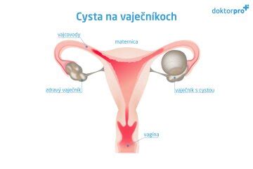 Schéma ženského reprodukčného systému