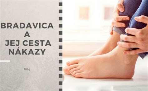 Starostlivosť o nohy diabetika