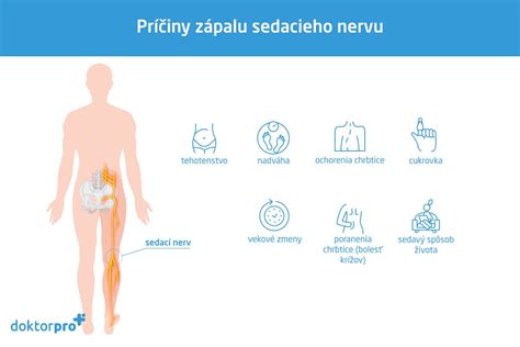 Hypoplázia zrakového nervu: príklady zobrazení MRI