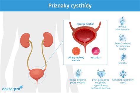 príznaky pooperačnej infekcie a zápalu