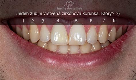 Rozdiel medzi turistom a pútnikom