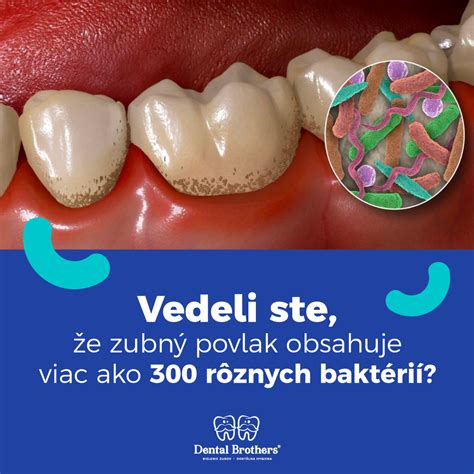 Rozdiel medzi zubnou prehliadkou a dentálnou hygienou