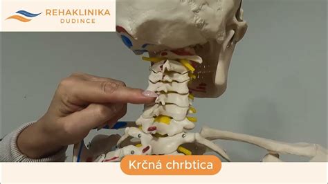 Zlomená krčná chrbtica, zobrazená röntgenom alebo CT snímkou