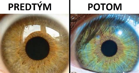 Potraviny, ktoré môžu zmeniť farbu stolice